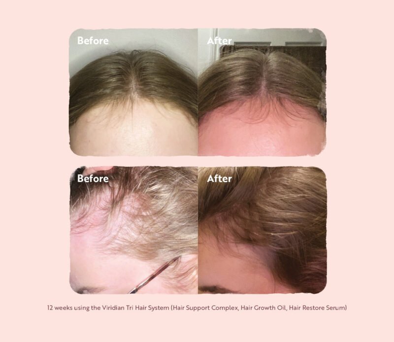 HAIR_TRIAL_GRAPHIC_1A-1.jpg